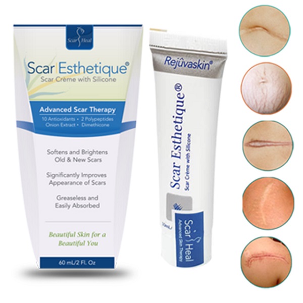 Kem Mờ Sẹo Scar Esthetique giá tốt